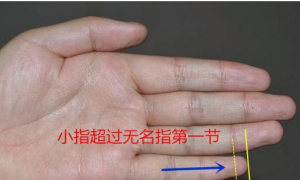 小拇指多一条横纹手相图解 小拇指有横纹的手相
