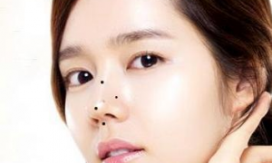 女人鼻子上的痣图解鼻子不同位置长痣代表着什么第一星