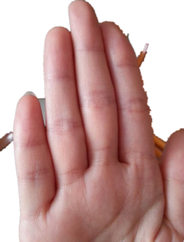 我觉得比较准的是看右手(你是女的)的5个手指头的纹路.