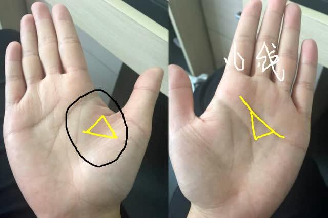 手相中感情线出现这种三角形纹路,象征着有不好的是发生