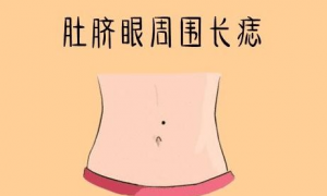 女人肚脐痣相代表什么 女人肚脐长痣福气足图