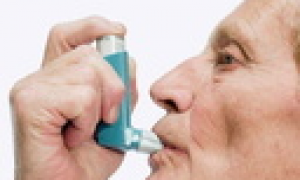 咳嗽变异性哮喘症状 鼻炎导致的咳嗽变异性哮喘症状